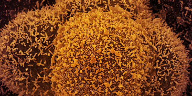 Brasil: Fiocruz alerta para aumento de casos de Covid-19 em quatro estados