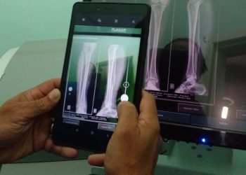 Anchieta: Pronto Atendimento inicia serviço de traumatologia para urgências