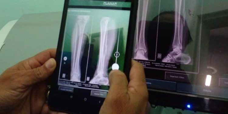 Anchieta: Pronto Atendimento inicia serviço de traumatologia para urgências