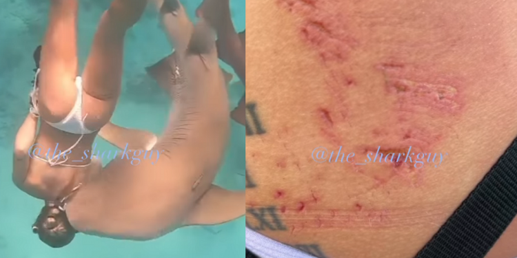 Mundo: Mulher é atacada por tubarão durante ensaio fotográfico
