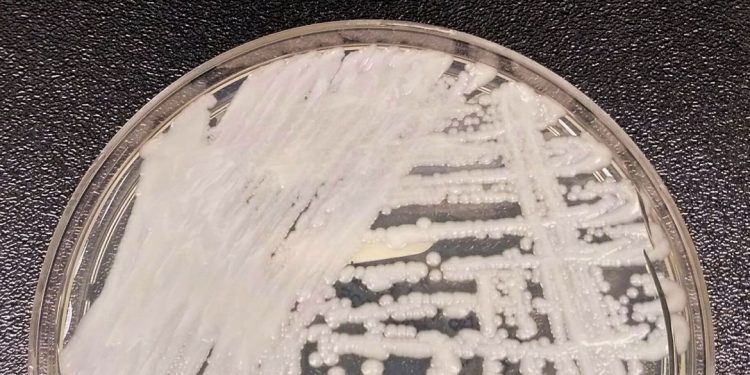 Brasil: Fiocruz e Pasteur pesquisam sobre danos dos fungos no ser humano