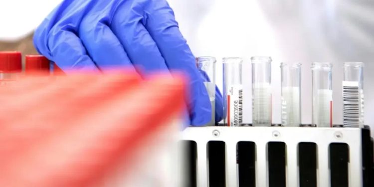 Eris: Brasil confirma mais dois casos da nova variante da covid-19