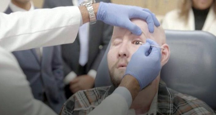 EUA: Veterano recebe primeiro transplante de olho do mundo
