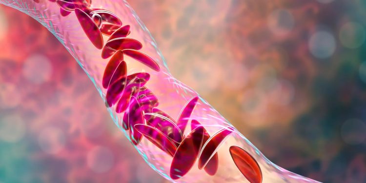 EUA: FDA aprova primeiro tratamento com edição genética do DNA