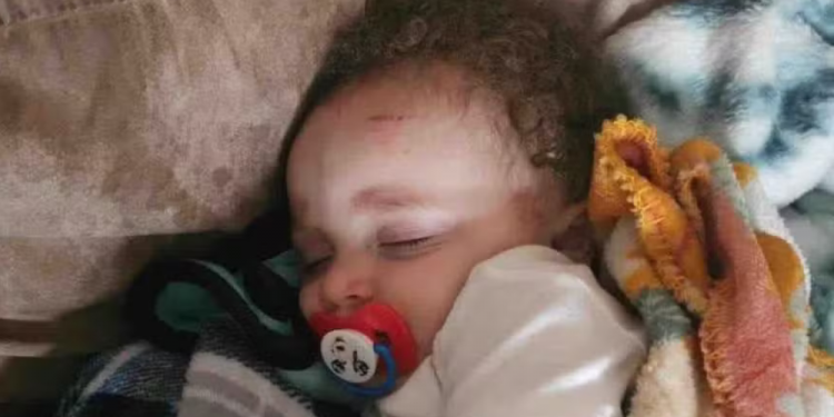 EUA: Bebê de 4 meses é encontrado vivo na copa de uma árvore após ser levado por tornado