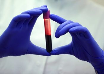 Saúde: Suécia trabalha em exame de sangue para a doença de Alzheimer