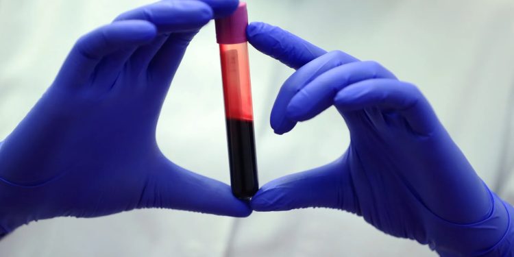 Saúde: Suécia trabalha em exame de sangue para a doença de Alzheimer