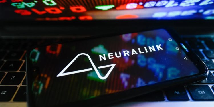 Neuralink: o que você precisa saber sobre o implante cerebral