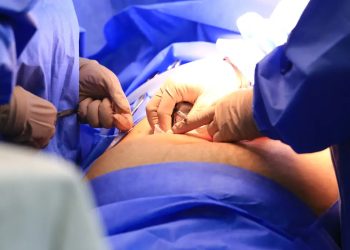 Brasil: Câmara aprova projeto que obriga divulgação de lista de espera do SUS