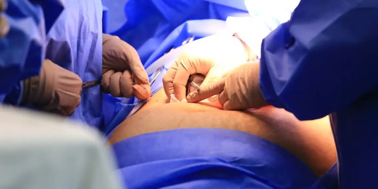 Brasil: Câmara aprova projeto que obriga divulgação de lista de espera do SUS