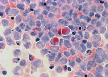 Mundo: Novo tratamento com células-tronco abre caminhos contra a leucemia