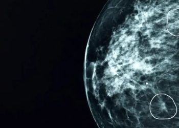 Mundo: Ferramenta de IA é capaz de detectar tumores que passaram desapercebidos