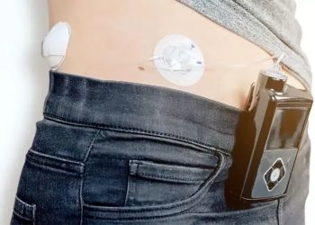 Diabetes: Reino Unido oferece ‘pâncreas artificial’ na rede pública