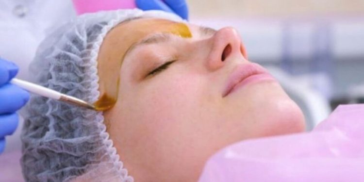 Peeling de fenol: O que é e quais cuidados devem ser tomados