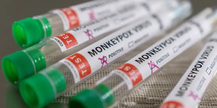 Saúde: Brasil registra 709 casos de mpox no país
