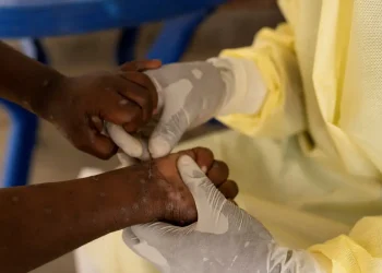 Mpox: Vacina brasileira está próxima dos testes em humanos