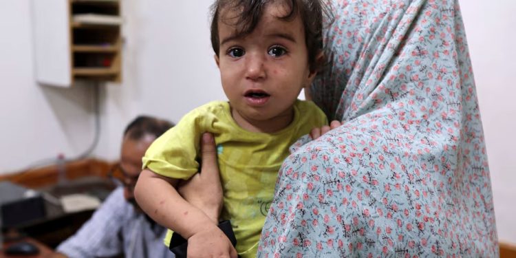 OMS: Israel e Hamas estabelecem pausas de três dias na luta por vacinas contra a poliomielite em Gaza