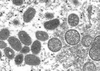 São Paulo: Estado registrou 315 casos de mpox de janeiro a julho deste ano
