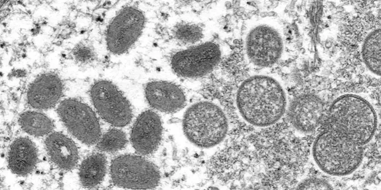 São Paulo: Estado registrou 315 casos de mpox de janeiro a julho deste ano