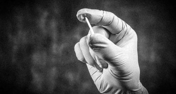 Chips da beleza: Anvisa proíbe venda e uso de implantes hormonais