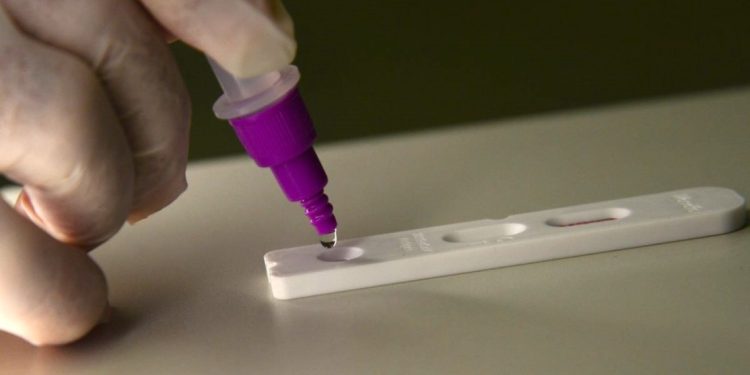 Anchieta: Testes Rápidos de Covid-19 disponíveis para a população