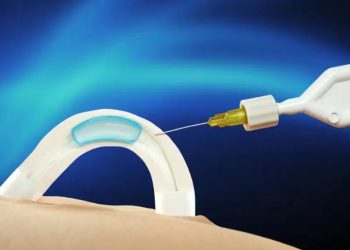 Austrália: Contraceptivo masculino por implante avança em testes