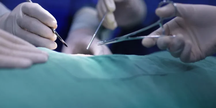 Doação de Órgãos: Brasil tem mais de 80 mil pessoas na fila