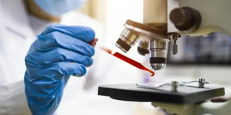 Pesquisa: Brasileiros avançam no diagnóstico de Alzheimer por exame de sangue