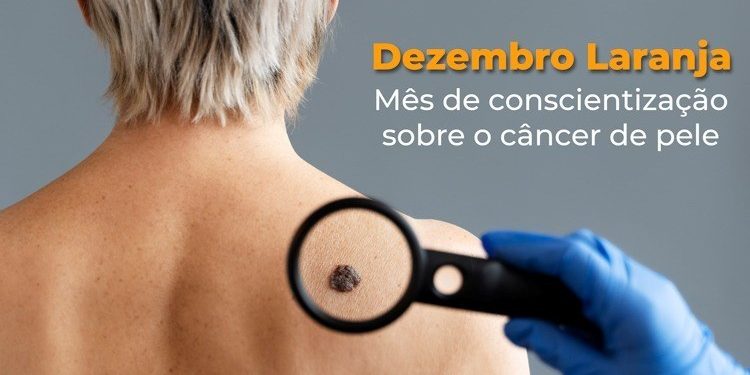 Espírito Santo: Dezembro Laranja reforça cuidados contra o câncer de pele