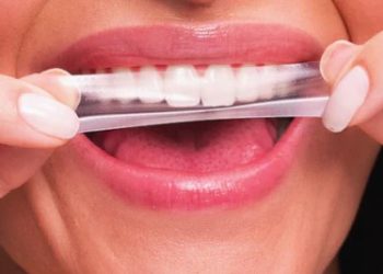 Anvisa: Agência manda recolher fitas de clareamento dental