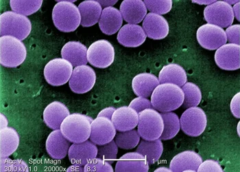 Brasil: Bactéria resistente ultrapassa hospitais e acende alerta para saúde pública