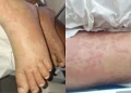 Saúde: Criança é internada por suspeita de contaminação após uso de detergente