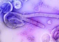 Saúde: O Ebola pode chegar ao Brasil?