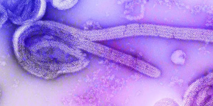 Saúde: O Ebola pode chegar ao Brasil?