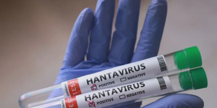Hantavírus: Quais as características da doença e de sua transmissão?
