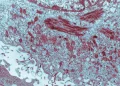 Ebola no Brasil: Suspeitas no Rio e em São Paulo são descartadas
