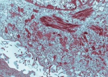 Ebola no Brasil: Suspeitas no Rio e em São Paulo são descartadas