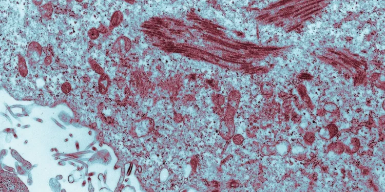 Ebola no Brasil: Suspeitas no Rio e em São Paulo são descartadas
